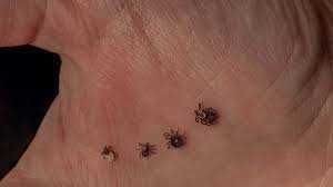 temp_image_1781847546.610371 Ticks in Quebec: Is Your Area at Risk for Lyme Disease?