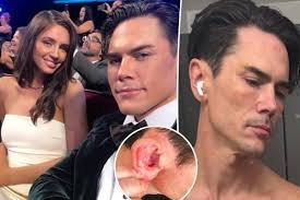 temp_image_1782432140.759054 Tom Sandoval Alleges Brutal Abuse: Victoria Robinson Arrested Following Shocking Incident