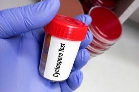 temp_image_1783034116.955843 Understanding Cyclosporiasis: A Guide to Cyclosporine Side Effects and Management