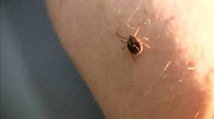 temp_image_1783985646.974547 Canada Tick Borne Diseases: Protecting Yourself from Lyme and Anaplasmosis