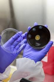 temp_image_1784522810.174202 Legionnaires' Disease: Symptoms, Causes, and Essential Prevention Tips