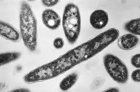 temp_image_1784564911.901353 Legionnaires' Disease Outbreak: Everything You Need to Know to Stay Safe