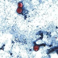 temp_image_1784974047.88445 Searching for 'Taco Bell Near Me'? Important Health Warning Regarding Recent Cyclospora Outbreak