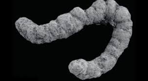 temp_image_1786224277.456959 Understanding Fecal Matter: What Your Bowel Movements Reveal About Your Health