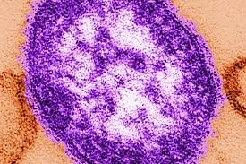 temp_image_1789373861.524134 Measles Outbreak in Pennsylvania: New Fatality Highlights Growing Public Health Crisis