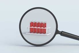 temp_image_1790247500.008994 The Future of Early Detection: Understanding the Galleri Multi-Cancer Blood Test